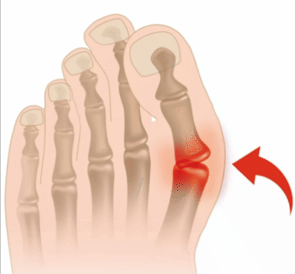 Meias de Correção de Joanete Foot Finger Control