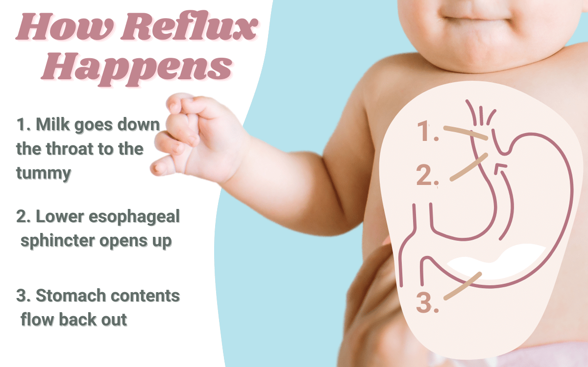 How Baby Reflux Happens?