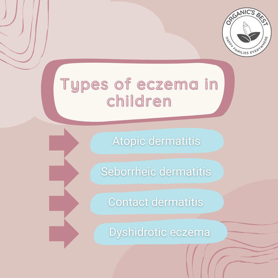 Types of eczema in children | Organics Best