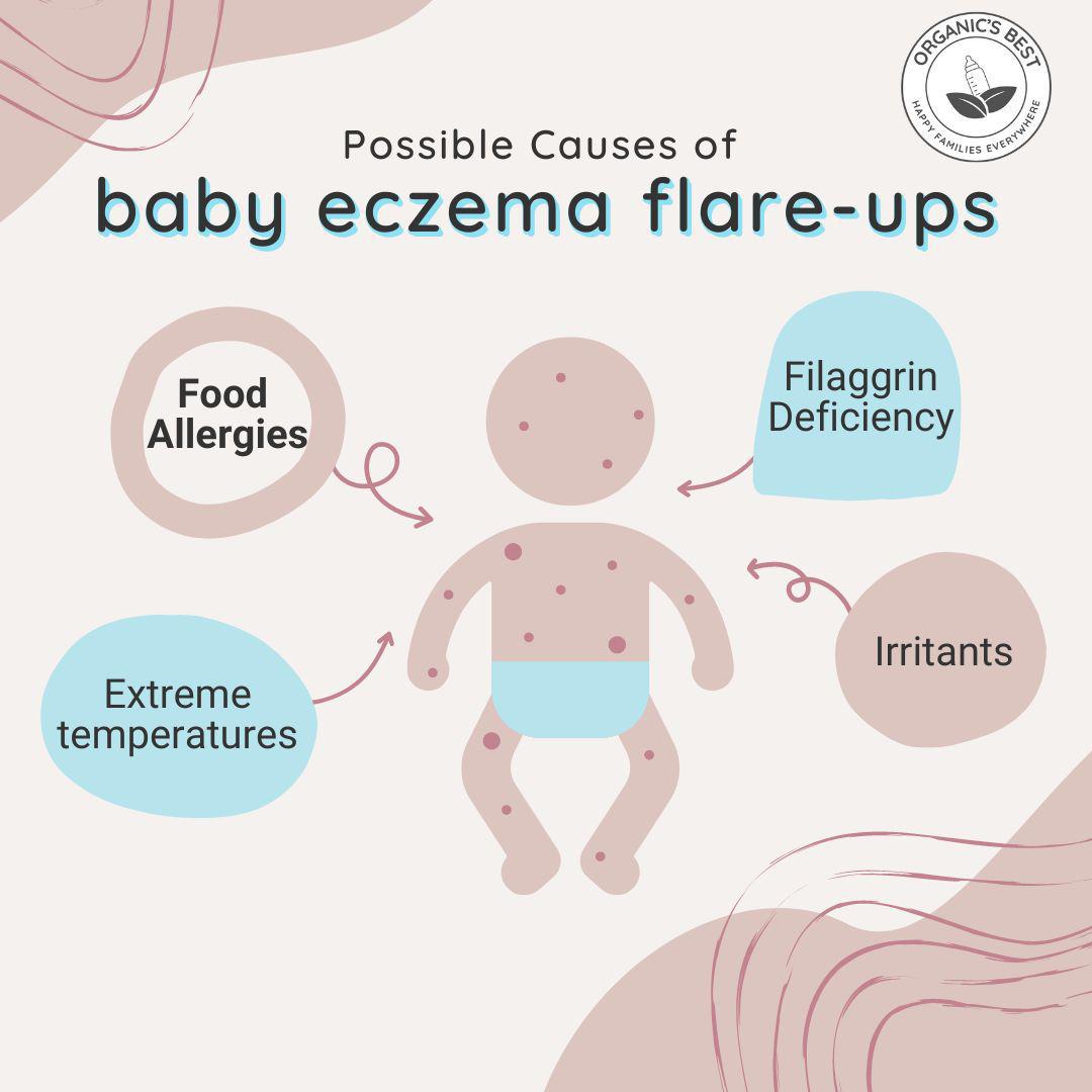Possible Causes of baby eczema flare-ups | Organics Best
