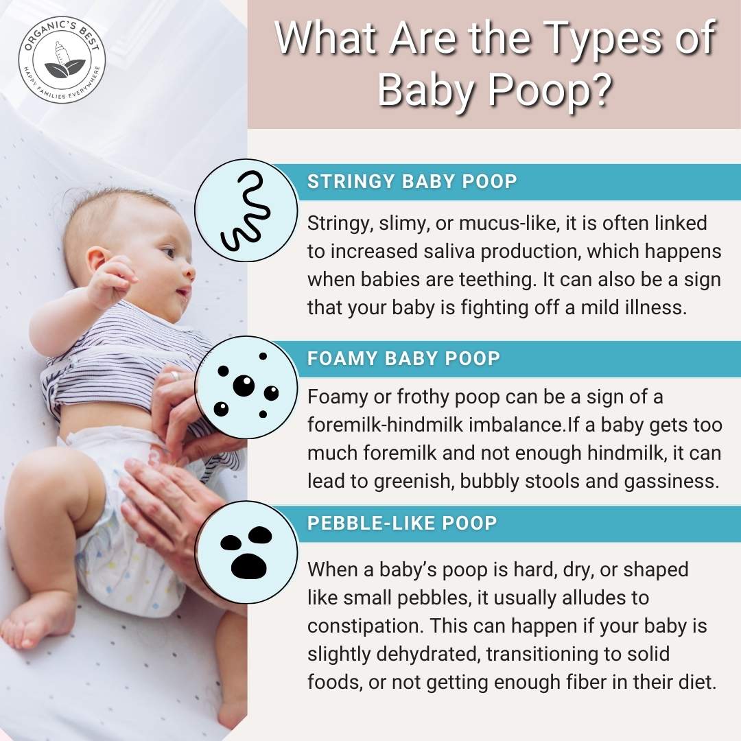 Types of Baby Poop