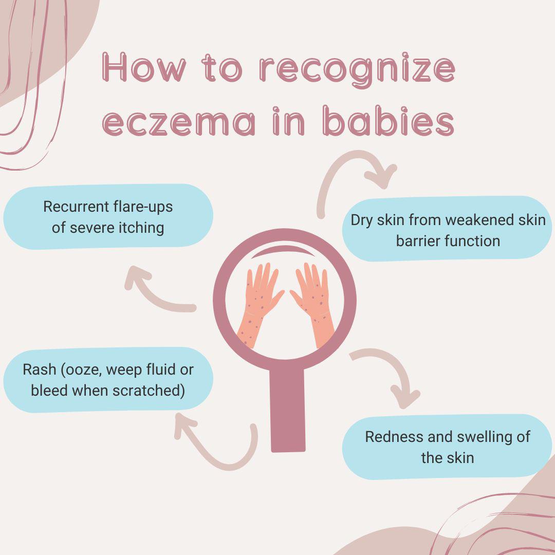 How to recognize eczema in babies | Organics Best