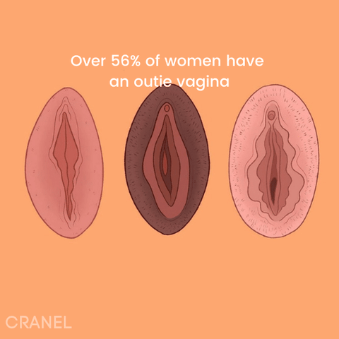 CRANEL vulva innie versus outtie