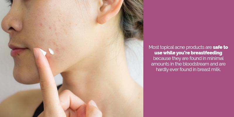 Postpartum Acne What Can You Do For Your Acne When You're Still Nursing?