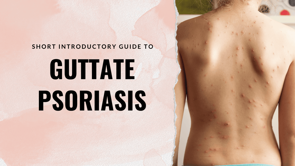 guttate psoriasis