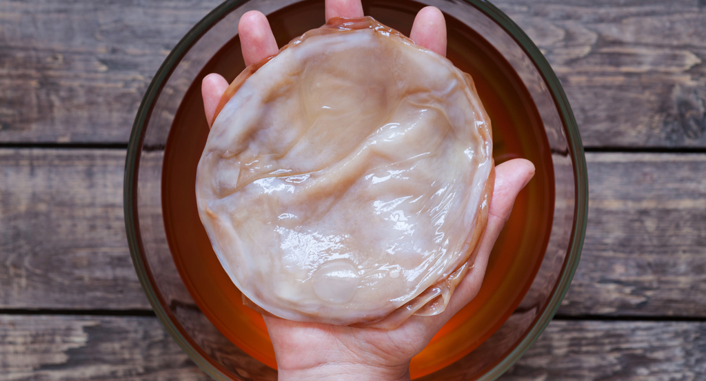 What is a SCOBY Made Of, and What Are Its Benefits?