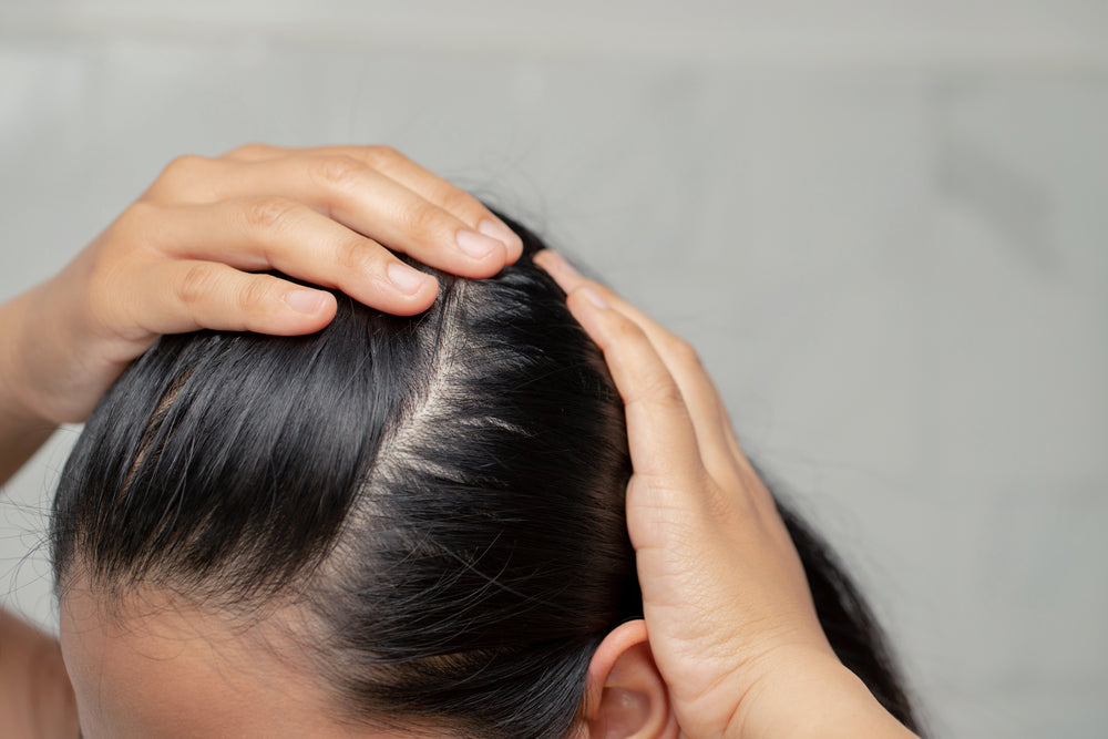 Woman with hair loss massaging her scalp