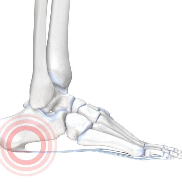 Heel Pain - Diagnosis, Treatment and Prevention
