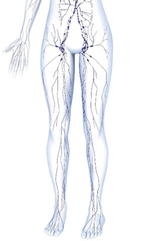 lymphœdème des jambes