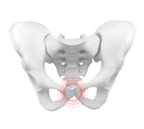 Treatment for symphysis pubis dysfunction available at local clinic