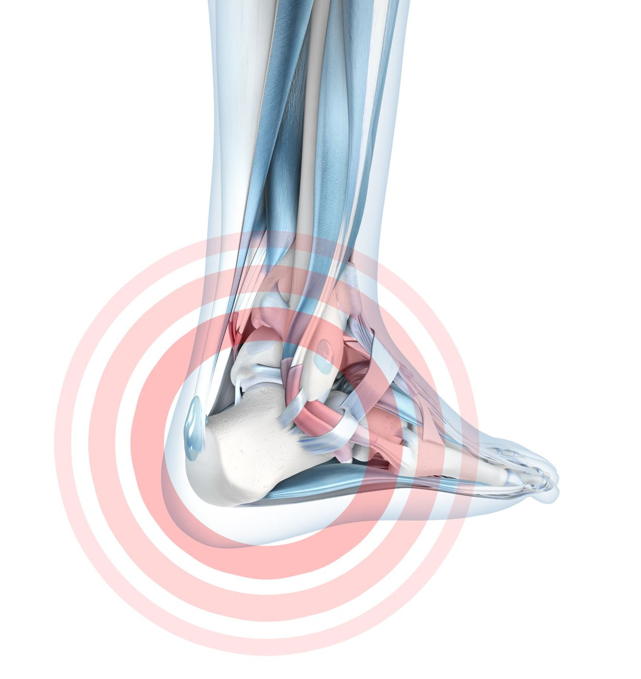 Deaconess - Understanding and Treating Heel Pain