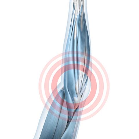 Elbow tendon pain