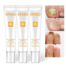 Load image into Gallery viewer, Fungal Nail Treatment Feet Care Essence Whitening Toe Nail Fungus Removal Gel Anti Infection Onychomycosis Nails Repair Essence - moonaro