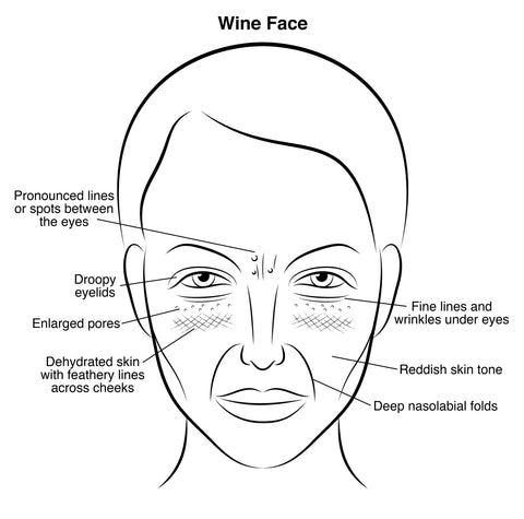 Signs of wine face, Dr Nigma