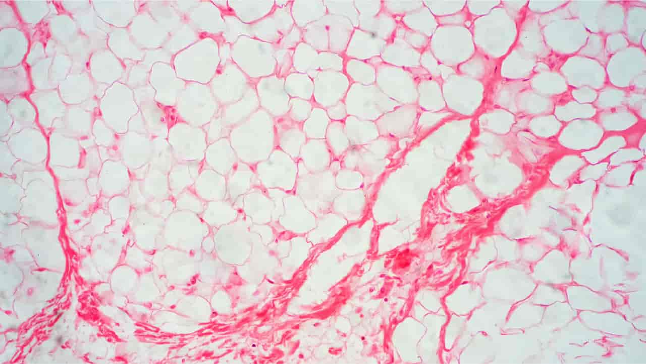 Human 'body fat' tissue under a microscope