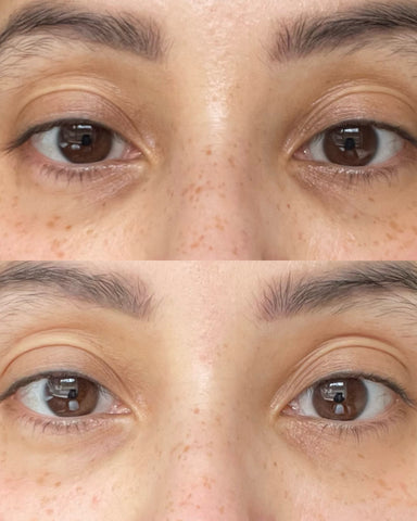 Before and After Saffron Gold Brightening Serum