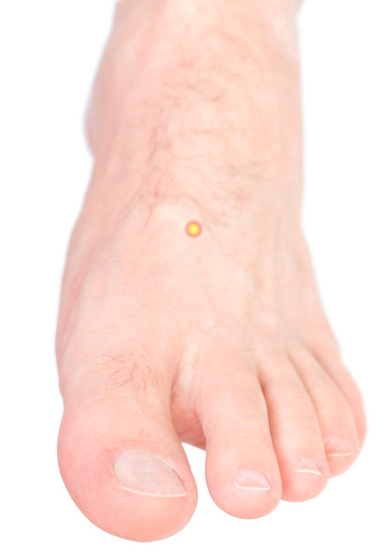 The acupressure point Tai Chong strengthens the psyche and in case of pain as well as movement disorders of the foot.