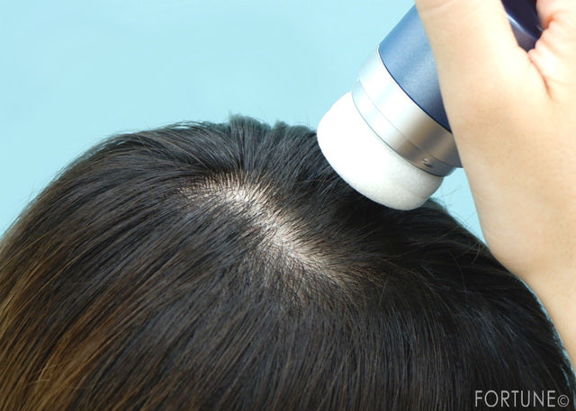 How To Get Rid Of Dandruff Naturally  18 Tips And Remedies