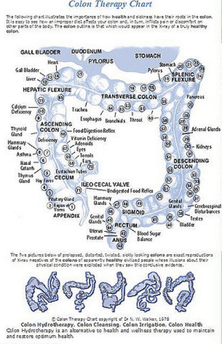 Colon Therapy Chart