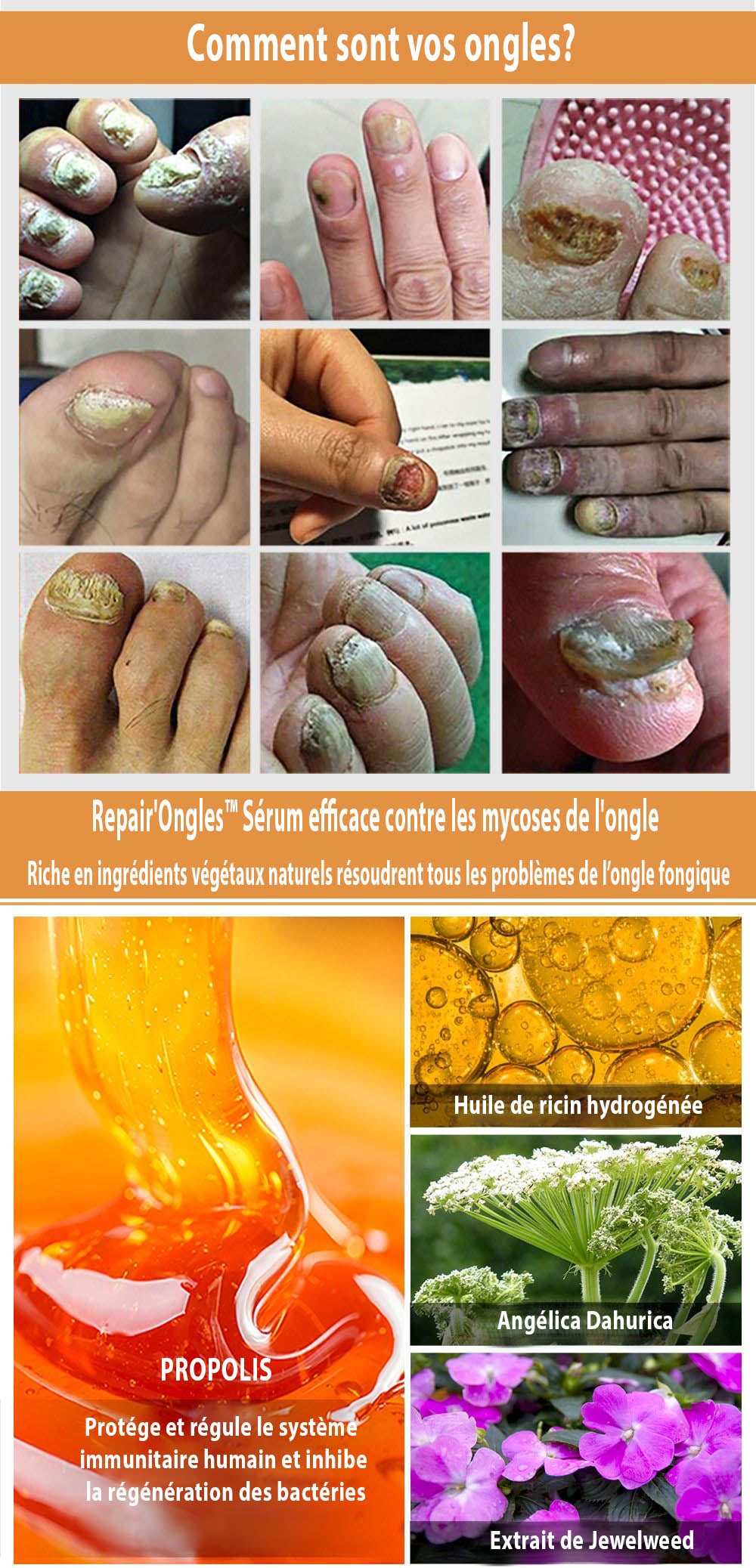 Repair Ongles Traitement Ultra Efficace Contre Les Mycoses De L Ongl Sevenzar