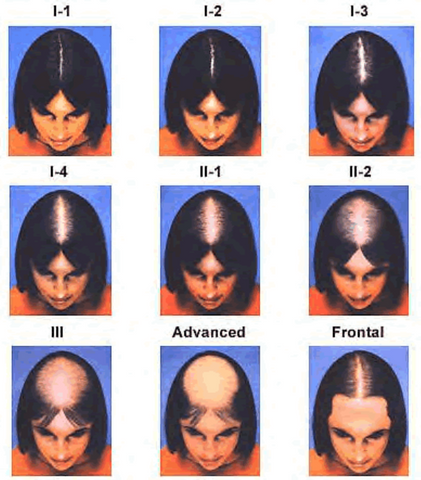 The Ludwig scale