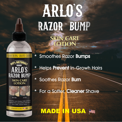 Arlo's Razor Bump Skin Care Lotion 6 oz – originalarlos