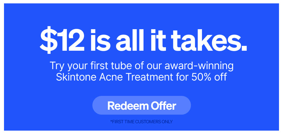 12 dollar skintone acne treatment offer