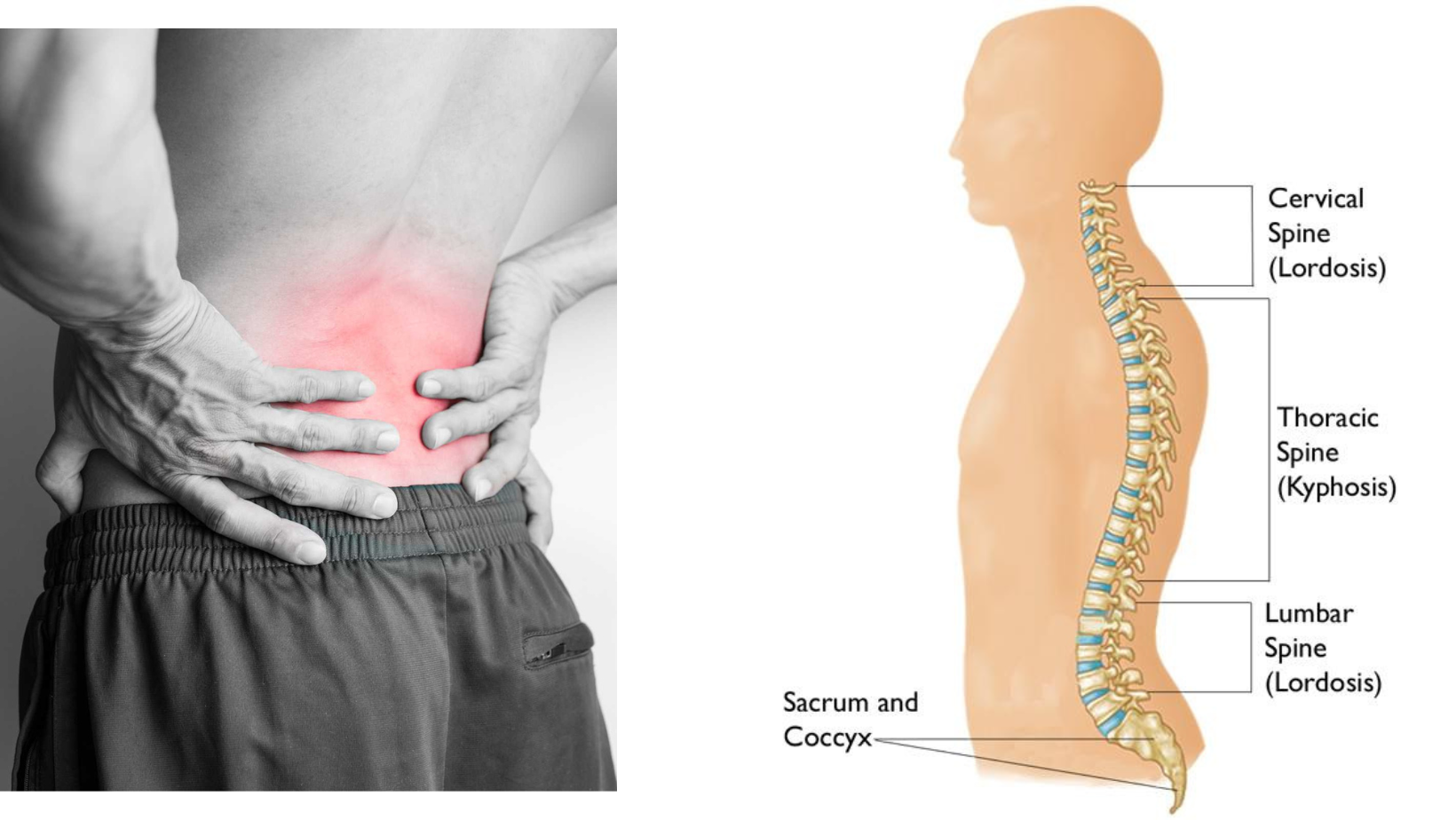 Back Pain Solutions 2023: Insights from the Experts