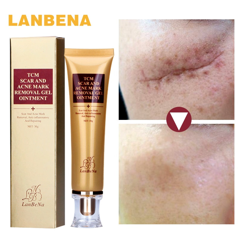 Lanbena Entfernen Akne Narben Reparatur Gel Hautpflege Rote Flecken Gesicht Creme Stretch Marks Pickel Narben Feuchtigkeitsspendende Anti Entzundliche De Grandado Com