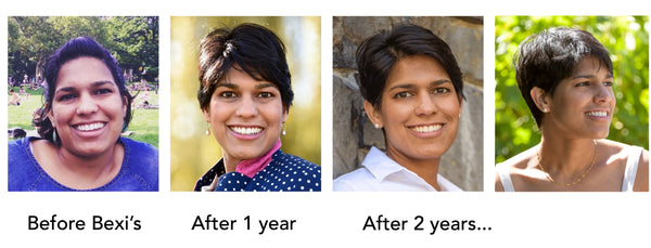 Bexi (Rebecca) Lobo, PhD, before and after using Bexi's skincare made with whole foods