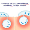 Clearasil® Rapid Rescue Acne Kit