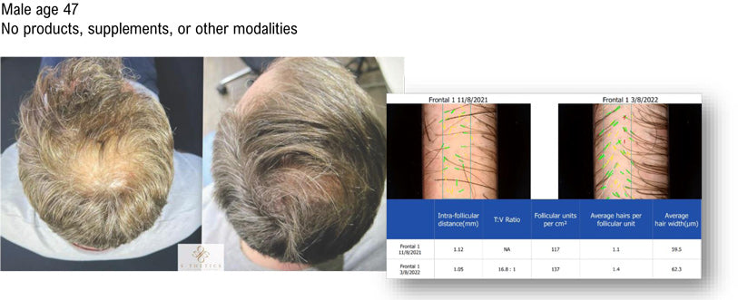 Celluma Restore Results