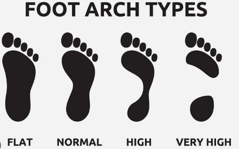 Feet arch,Normal arch,Flat feet,Flat arch,High arch