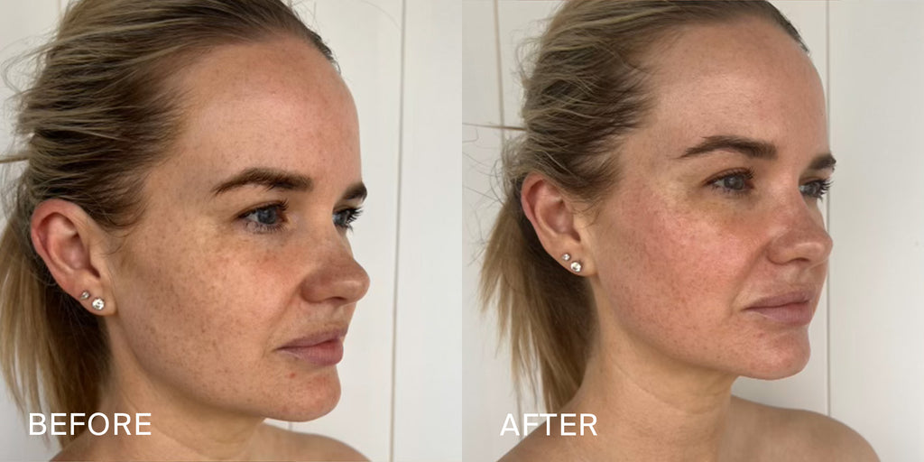 Before and After Results of Facial Workouts