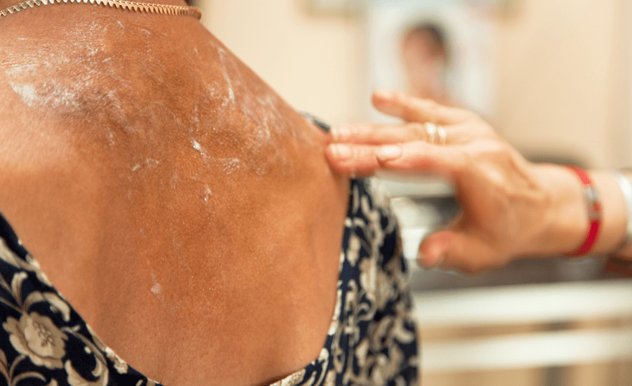 women getting back moisturized using nefertem tallow products