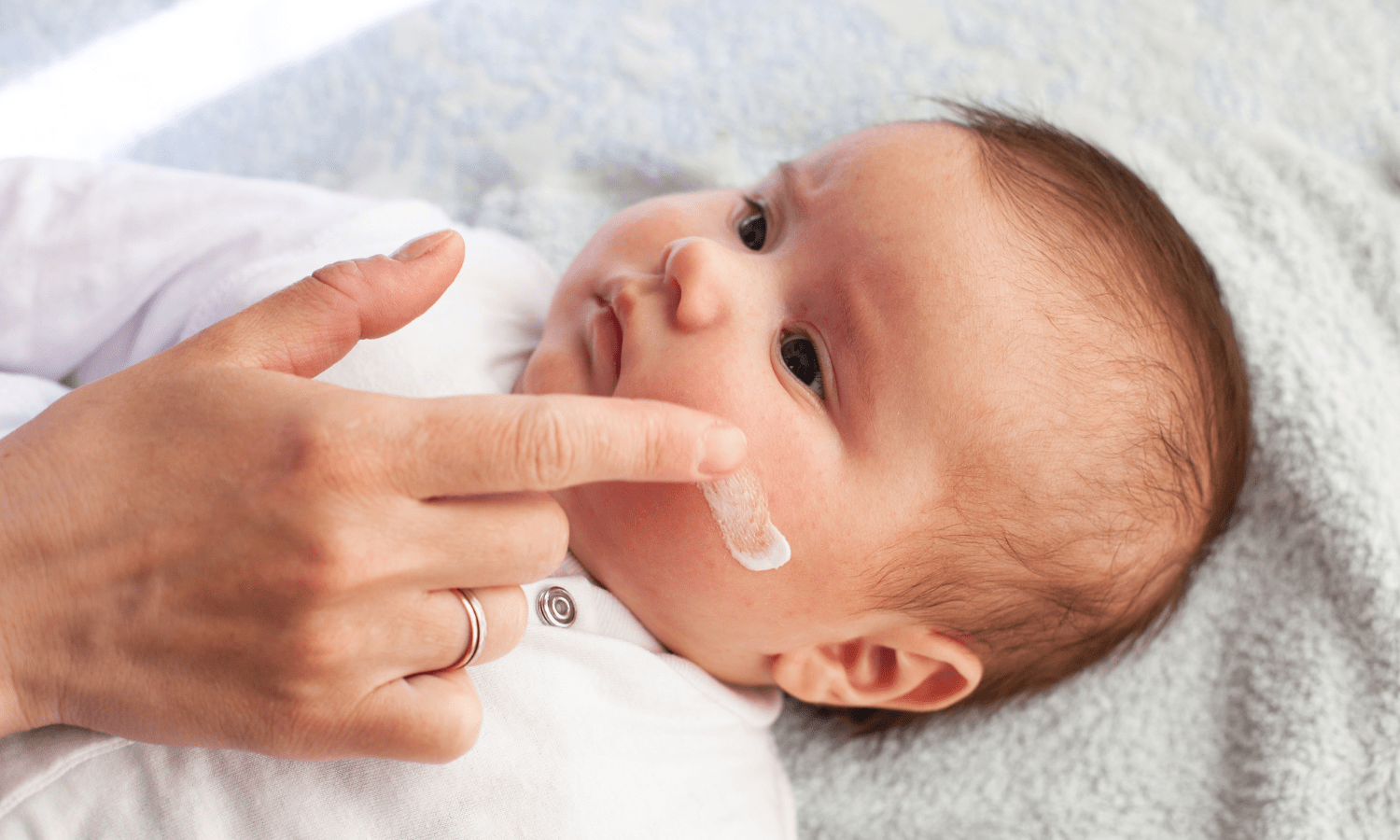 Baby getting moisturized on face to help with eczema 