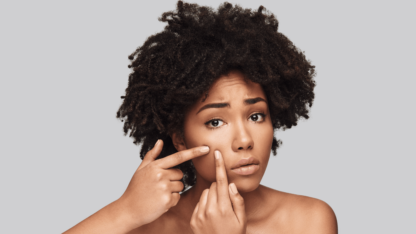 Chica negra con afro estresada por la piel.