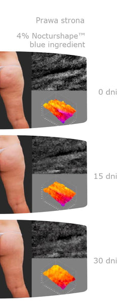 Crema Snellente Anticellulite con Notcurshape Nacomi