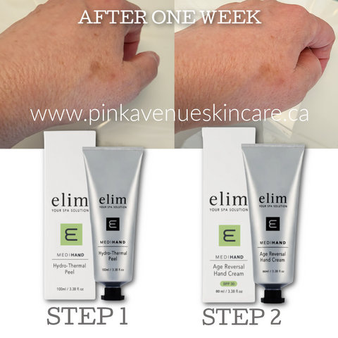 ELim MediHand Before and After,  Age Reversal Hand Cream, Hydro Thermal Peel, Pink Avenue, Toronto