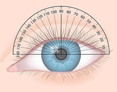 Los grados del astigmatismo y los distintos tipos de astigmatismo combinado con miopia o hipermetropia que existen