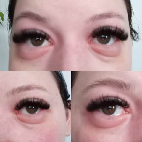 Allergic reaction to lash extensions - Personal Account from PLA, Day 3