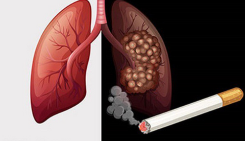 COPD and smoking