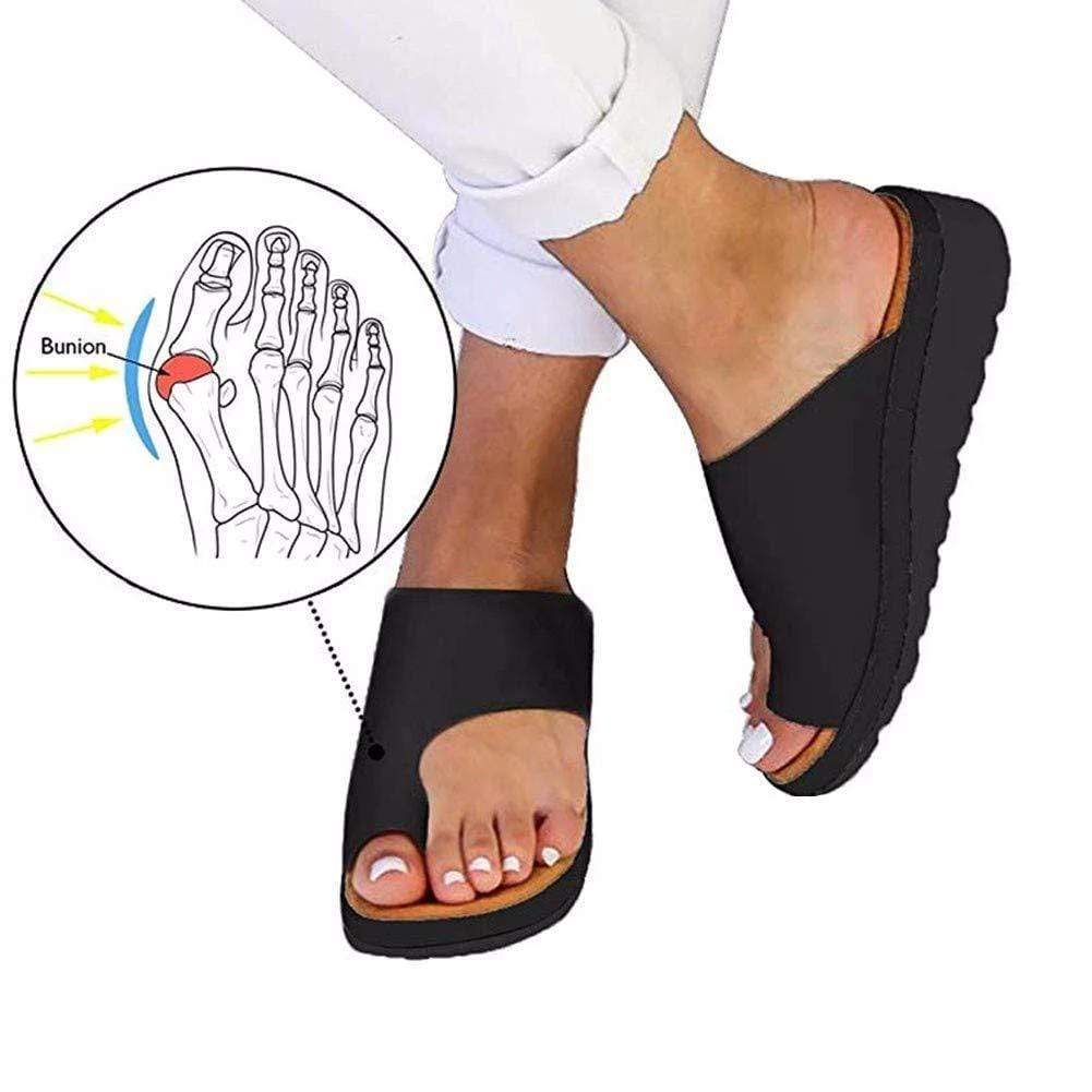 bunion corrector flip flops