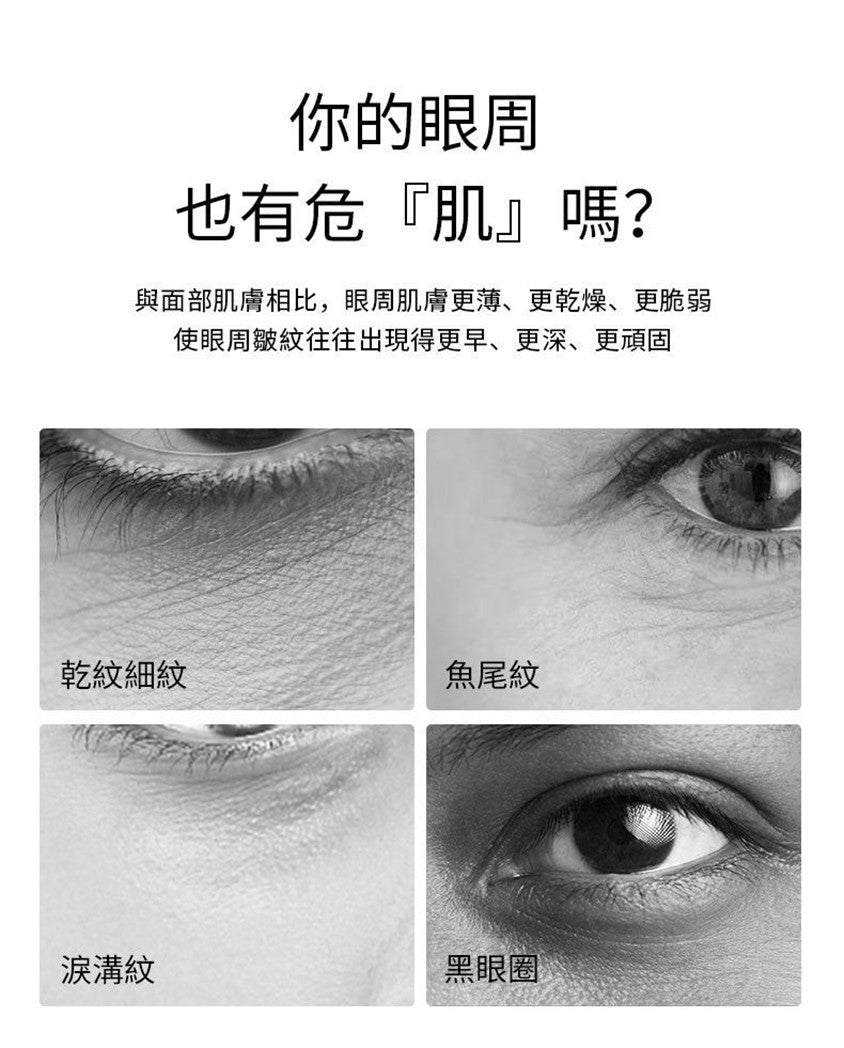 電動 美眼 急救 修 復貼 紅光 眼貼 新奇站 newkiland 眼 霜 眼袋 霜 推薦 眼袋 霜 黑 眼圈 黑 眼圈 消除 去 黑 眼圈 眼袋 淚 溝 去 眼袋 眼袋 槍 脂肪 粒 水腫