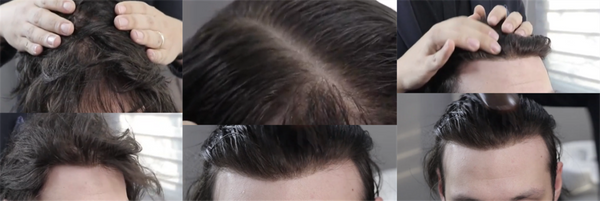 hair units for men