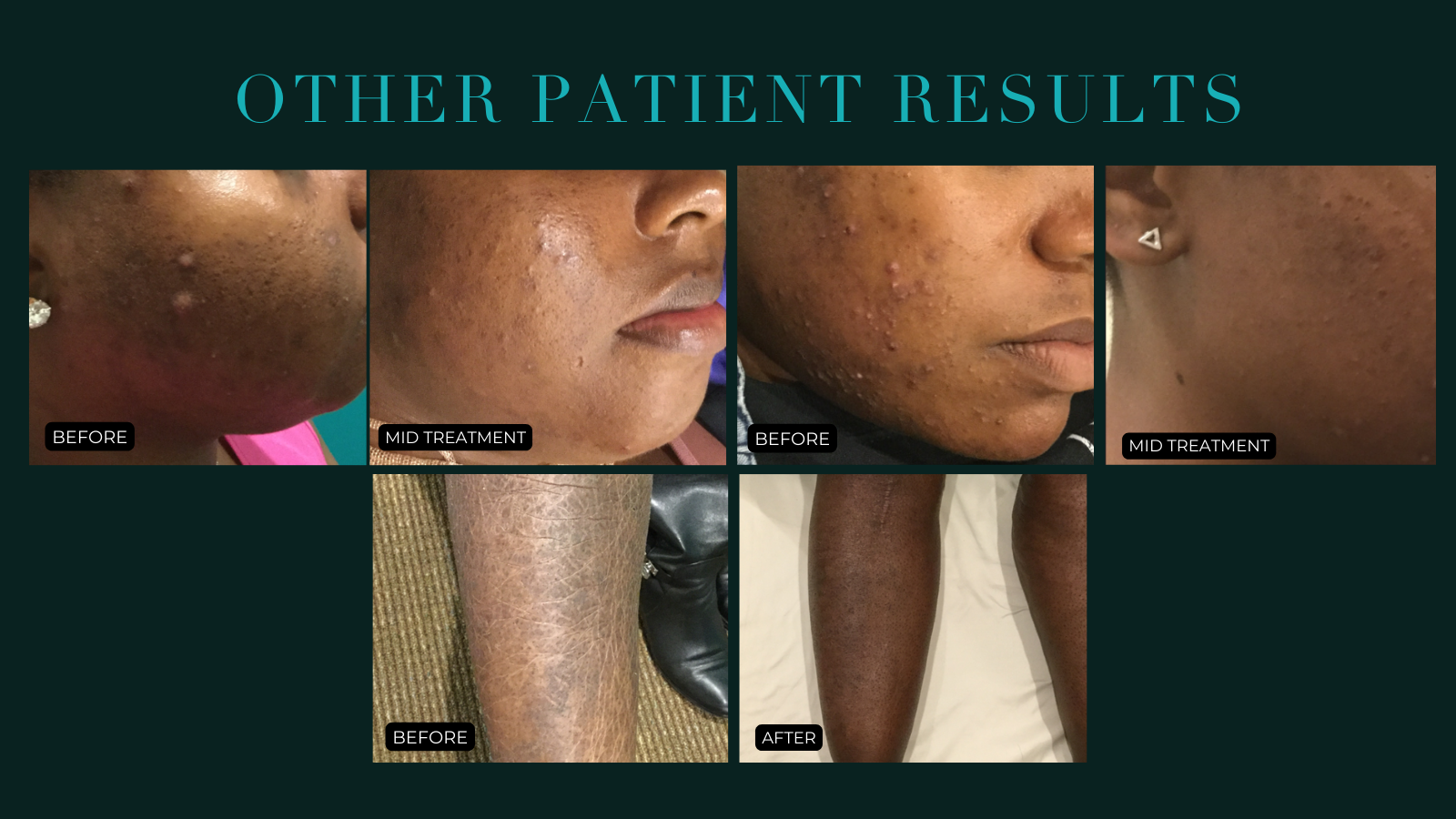 Other virtual onsultation patient results shawishi skincare 