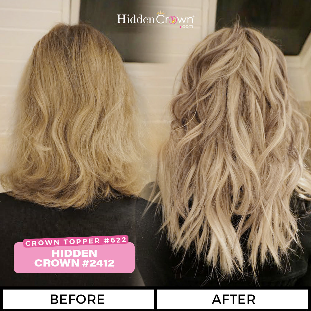 Hidden Crown® Hair | See Before and After Transformations - Hidden