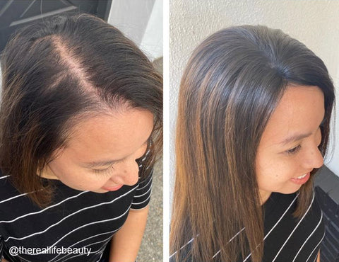How Can I Hide My Thinning Hair - Hidden Crown Hair Extensions
