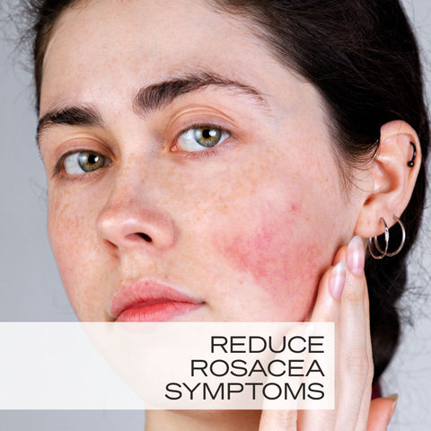 How to treat Rosacea