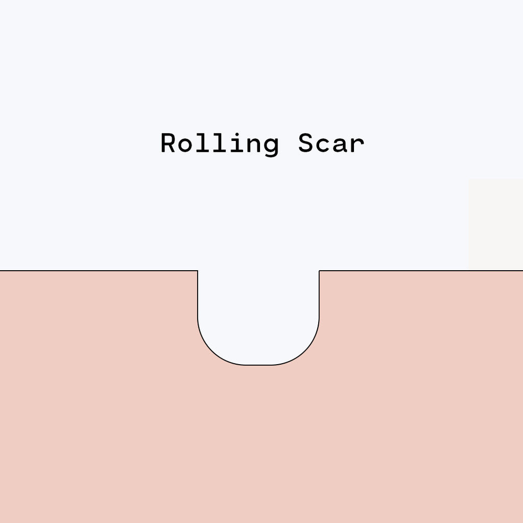 Rolling Scars